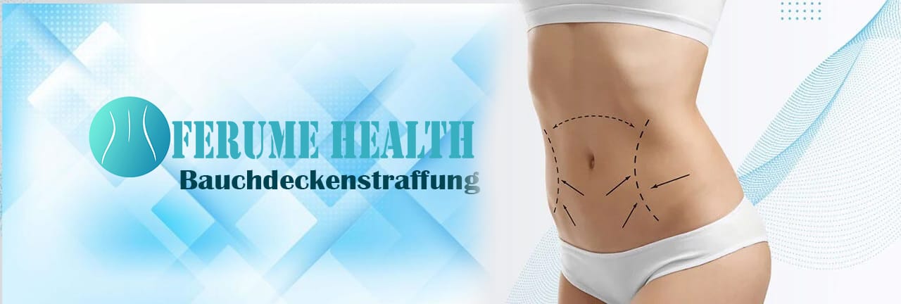 Bauchdeckenstraffung