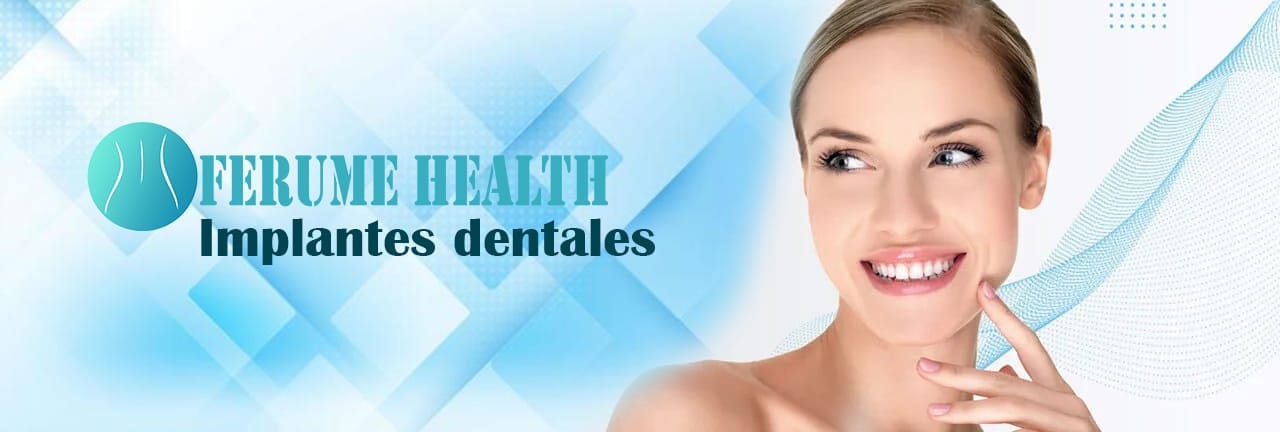 Implantes Dentales