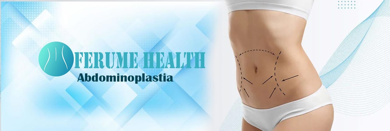 Abdominoplastia
